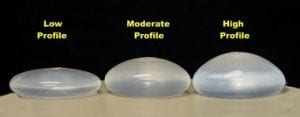 Low, Moderate and High profile implants Implants profile sizes